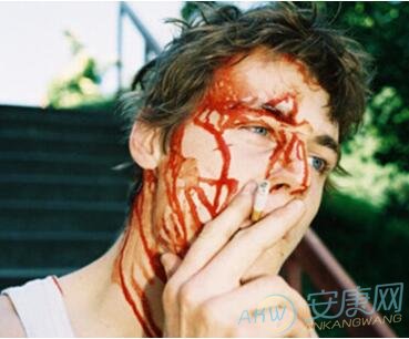梦境分析 梦见头部流血的含义分析是什么意思
