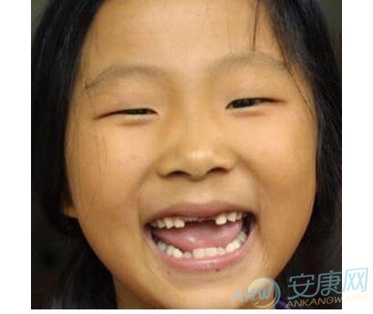 梦见小孩长牙齿有着怎样的好坏预示？是什么意思