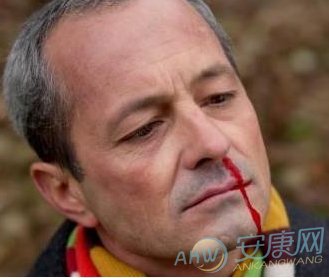 绝对不是好事！梦到鼻子出血介绍是什么意思