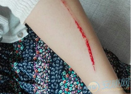 如何解读梦见手臂流血?从事物象征含义来看是什么意思
