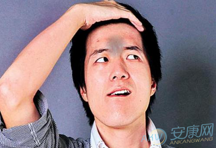 梦见印堂发黑是什么意思