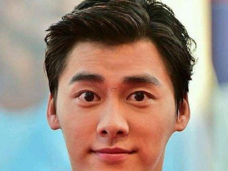 驼峰鼻克夫吗 驼峰鼻如何改善
