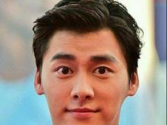 驼峰鼻克夫吗 驼峰鼻如何改善