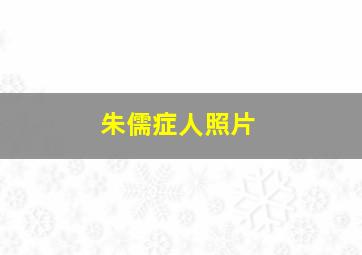 朱儒症人照片,朱儒症人照片女性